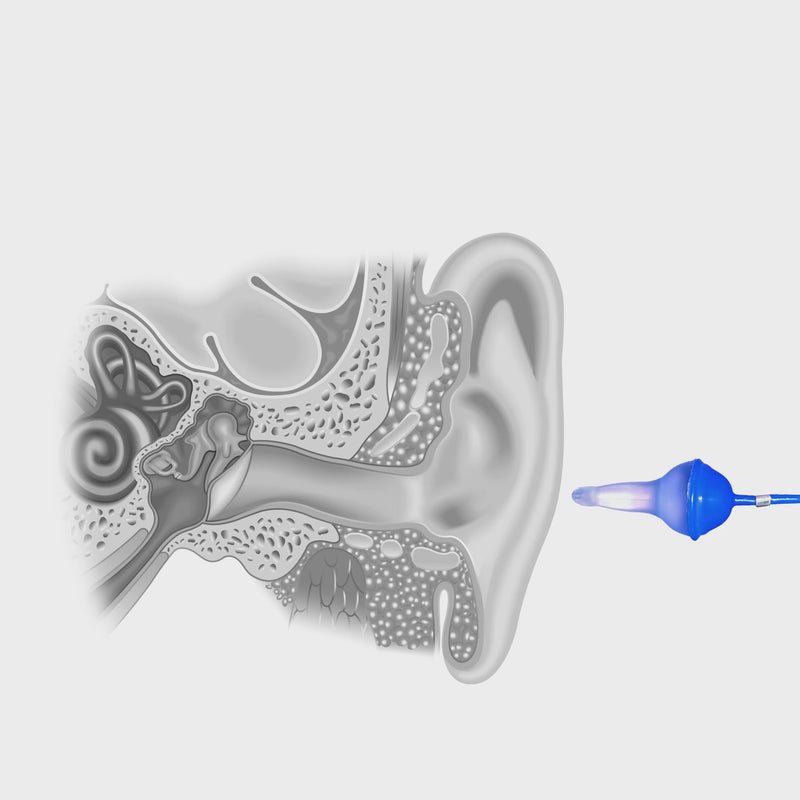 Fluid earplug inflation animation in the ear canal